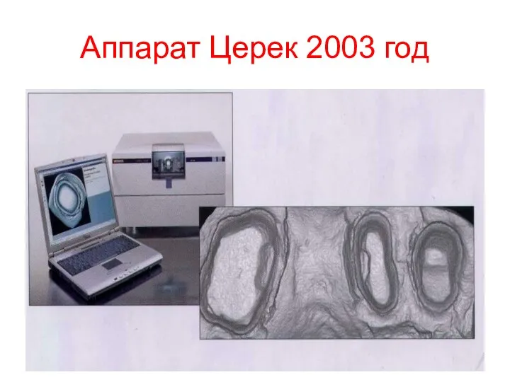 Аппарат Церек 2003 год