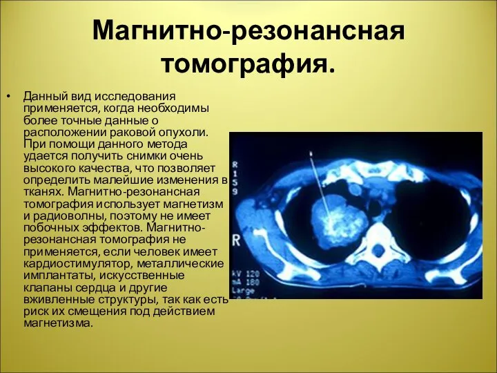 Магнитно-резонансная томография. Данный вид исследования применяется, когда необходимы более точные данные о