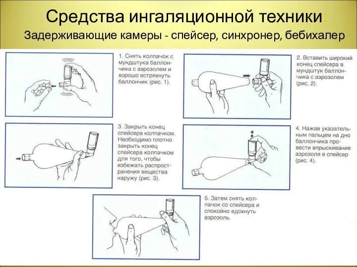 Средства ингаляционной техники: Задерживающие камеры - спейсер, синхронер, бебихалер