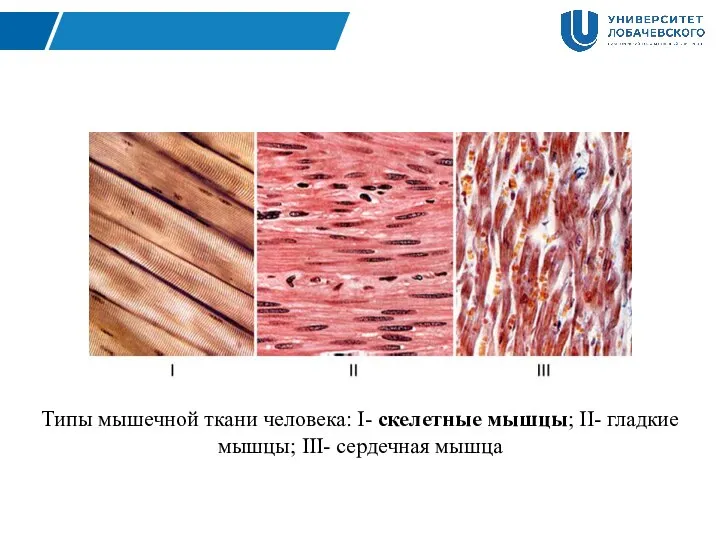 Типы мышечной ткани человека: I- скелетные мышцы; II- гладкие мышцы; III- сердечная мышца