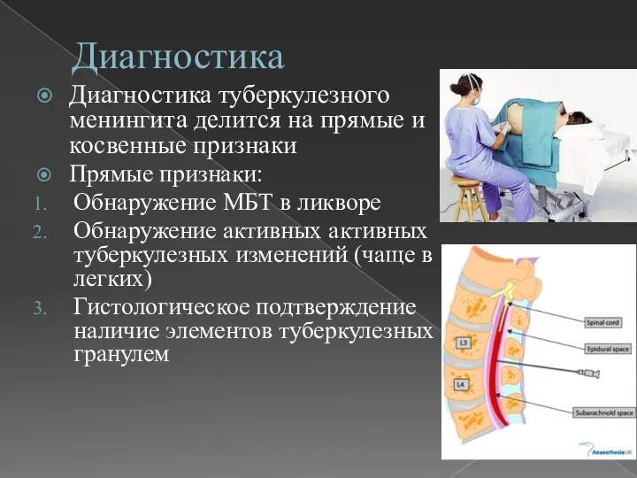 Диагностика Диагностика туберкулезного менингита делится на прямые и косвенные признаки Прямые признаки: