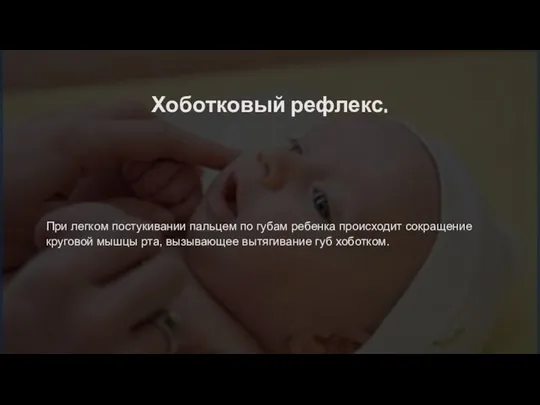 Хоботковый рефлекс. При легком постукивании пальцем по губам ребенка происходит сокращение круговой