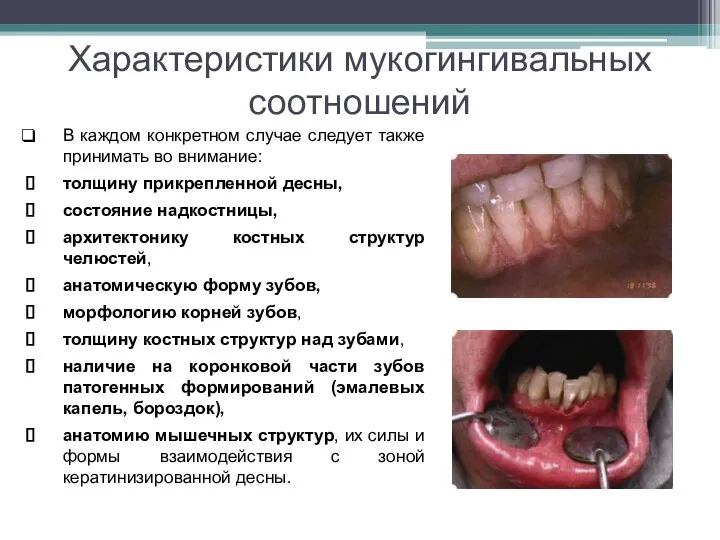 Характеристики мукогингивальных соотношений В каждом конкретном случае следует также принимать во внимание: