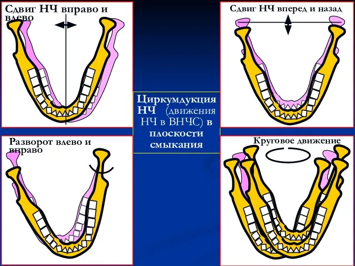 Циркумдукция НЧ (движения НЧ в ВНЧС) в плоскости смыкания
