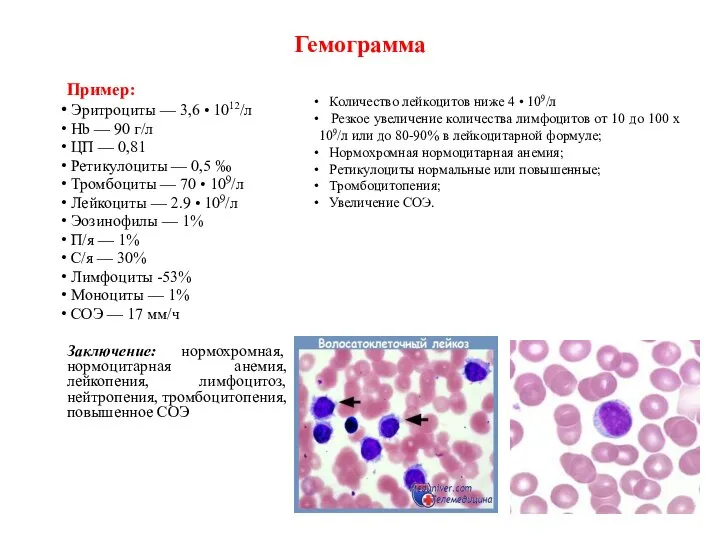 Гемограмма Пример: Эритроциты — 3,6 • 1012/л Hb — 90 г/л ЦП