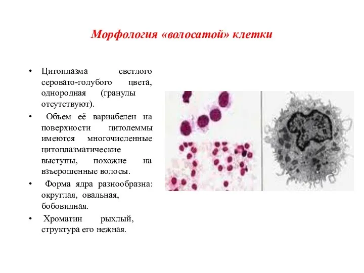 Морфология «волосатой» клетки Цитоплазма светлого серовато-голубого цвета, однородная (гранулы отсутствуют). Объем её