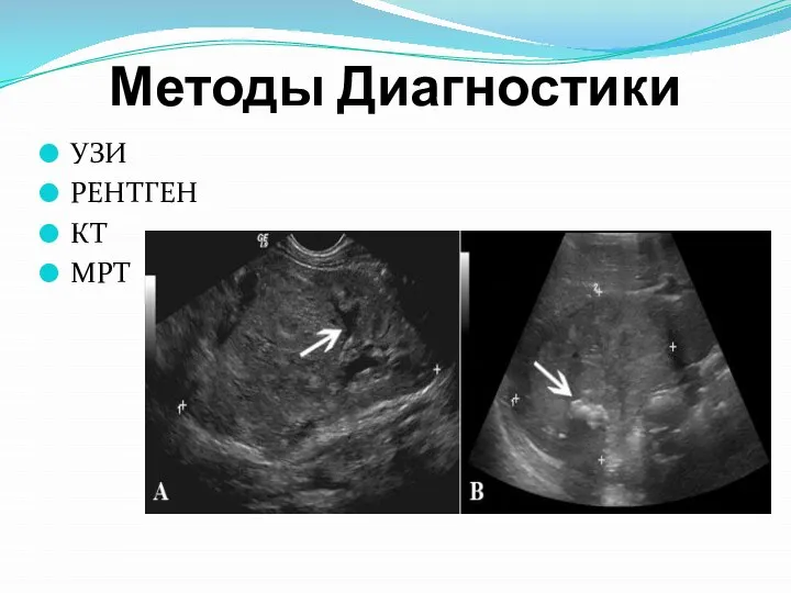 Методы Диагностики УЗИ РЕНТГЕН КТ МРТ