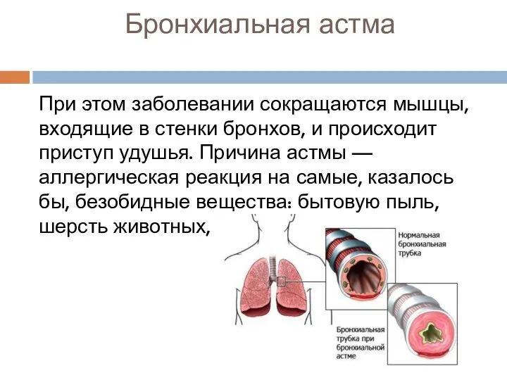 Бронхиальная астма При этом заболевании сокращаются мышцы, входящие в стенки бронхов, и