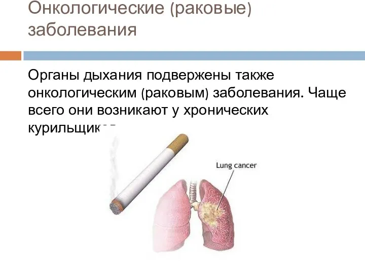 Онкологические (раковые) заболевания Органы дыхания подвержены также онкологическим (раковым) заболевания. Чаще всего