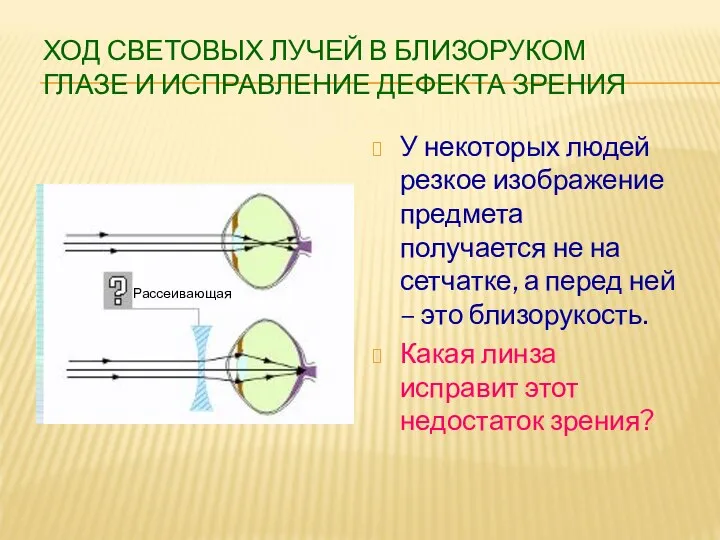 ХОД СВЕТОВЫХ ЛУЧЕЙ В БЛИЗОРУКОМ ГЛАЗЕ И ИСПРАВЛЕНИЕ ДЕФЕКТА ЗРЕНИЯ У некоторых