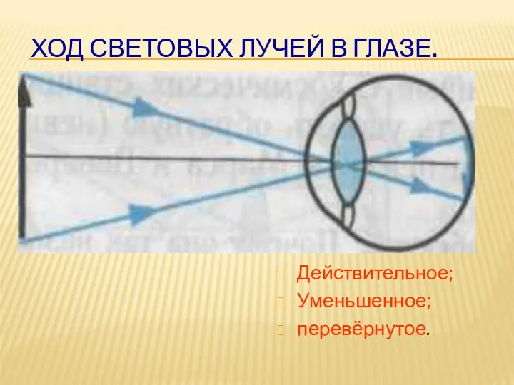 ХОД СВЕТОВЫХ ЛУЧЕЙ В ГЛАЗЕ. Действительное; Уменьшенное; перевёрнутое.