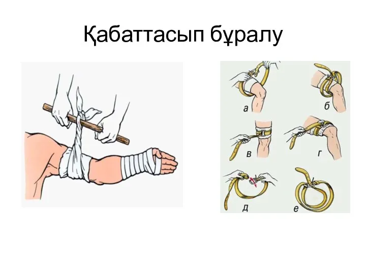 Қабаттасып бұралу