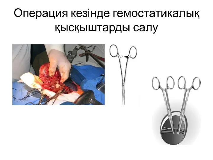 Операция кезінде гемостатикалық қысқыштарды салу