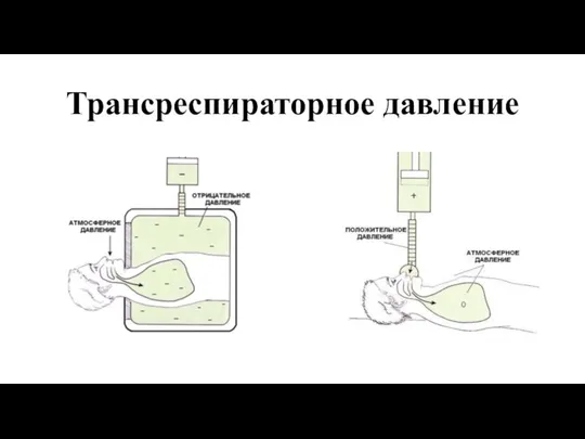 Трансреспираторное давление