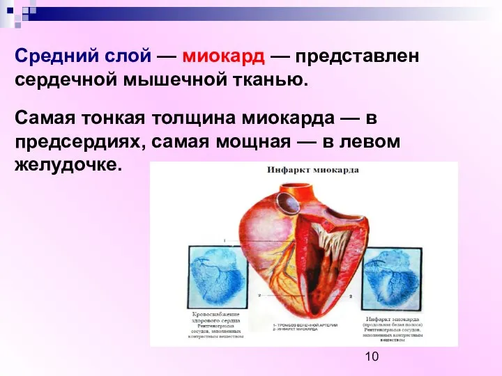 Средний слой — миокард — представлен сердечной мышечной тканью. Самая тонкая толщина