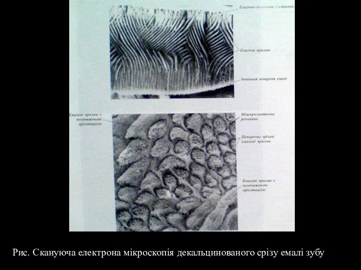 Рис. Скануюча електрона мікроскопія декальцинованого срізу емалі зубу