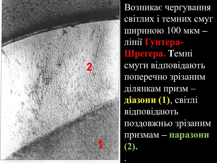 Возникає чергування світлих і темних смуг шириною 100 мкм –лінії Гунтера-Шрегера. Темні