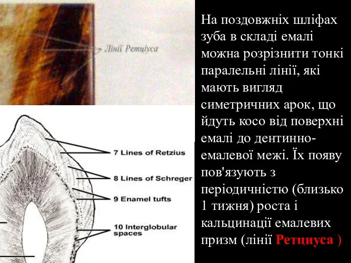 На поздовжніх шліфах зуба в складі емалі можна розрізнити тонкі паралельні лінії,
