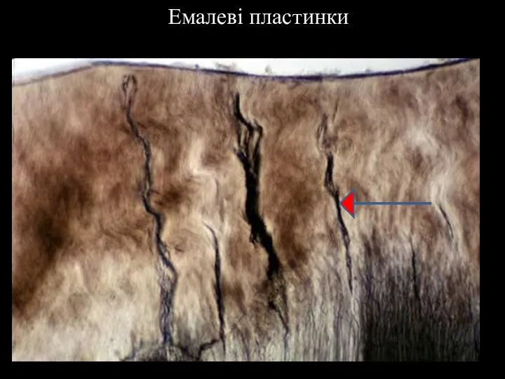 Емалеві пластинки