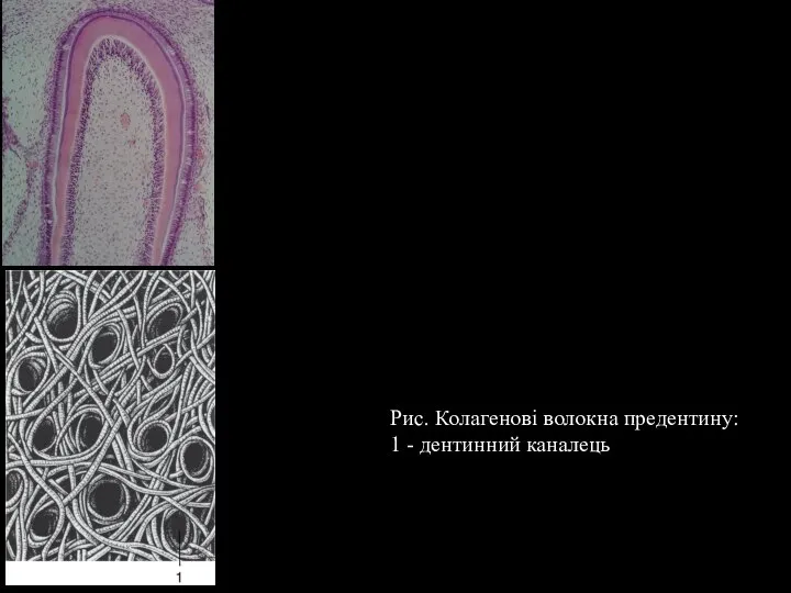 Рис. Колагенові волокна предентину: 1 - дентинний каналець