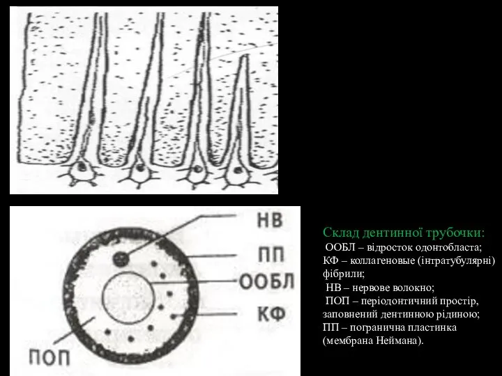 Склад дентинної трубочки: ООБЛ – відросток одонтобласта; КФ – коллагеновые (інтратубулярні) фібрили;