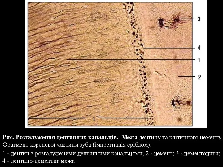 Рис. Розгалуження дентинних канальців. Межа дентину та клітинного цементу. Фрагмент кореневої частини