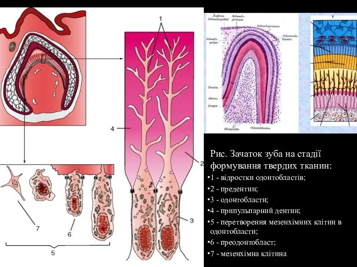 Рис. Зачаток зуба на стадії формування твердих тканин: 1 - відростки одонтобластів;