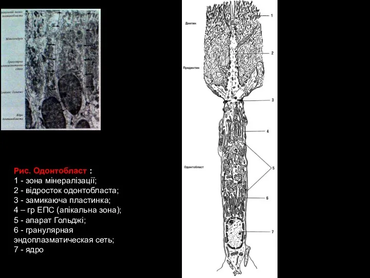 Рис. Одонтобласт : 1 - зона мінералізації; 2 - відросток одонтобласта; 3