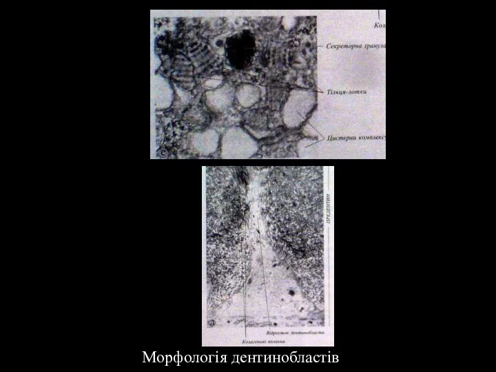 Морфологія дентинобластів