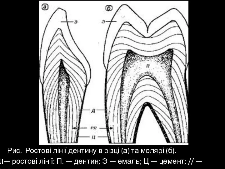 Рис. Ростові лінії дентину в різці (а) та молярі (б). PJI— ростові