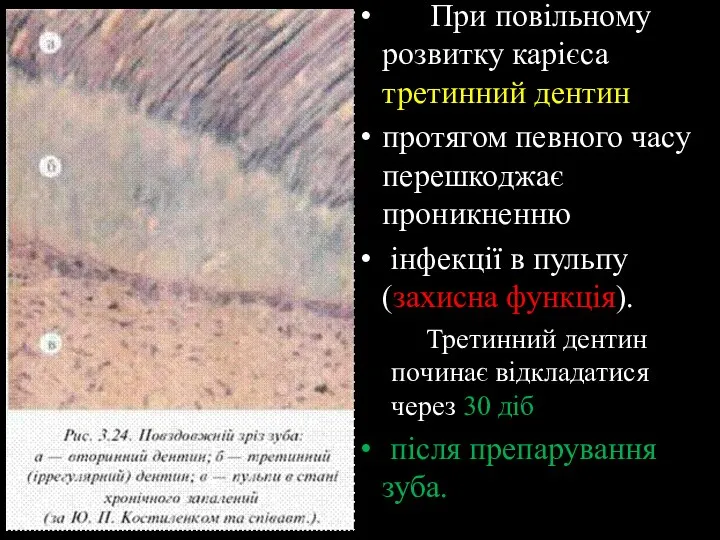 При повільному розвитку карієса третинний дентин протягом певного часу перешкоджає проникненню інфекції