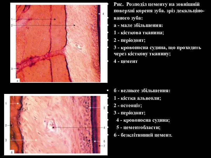 Рис. Розподіл цементу на зовнішній поверхні кореня зуба. зріз декальціно- ваного зуба: