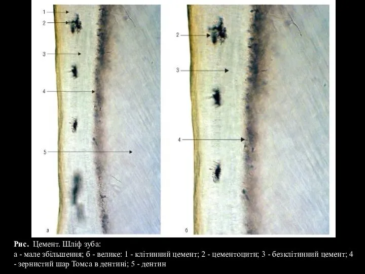 Р Рис. Цемент. Шліф зуба: а - мале збільшення; б - велике:
