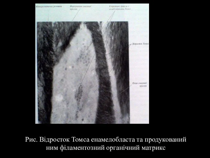 Рис. Відросток Томса енамелобласта та продукований ним філаментозний органічний матрикс