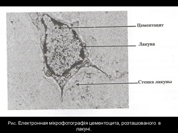 Рис. Електронная мікрофотографія цементоцита, розташованого в лакуні. Цементоциты -