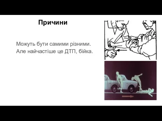 Причини Можуть бути самими різними. Але найчастіше це ДТП, бійка.