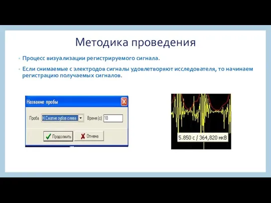 Методика проведения Процесс визуализации регистрируемого сигнала. Если снимаемые с электродов сигналы удовлетворяют