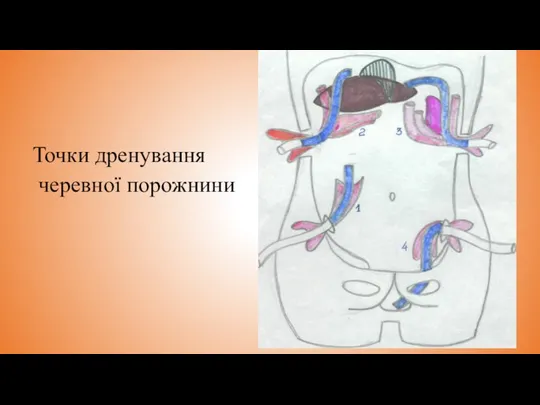 Точки дренування черевної порожнини