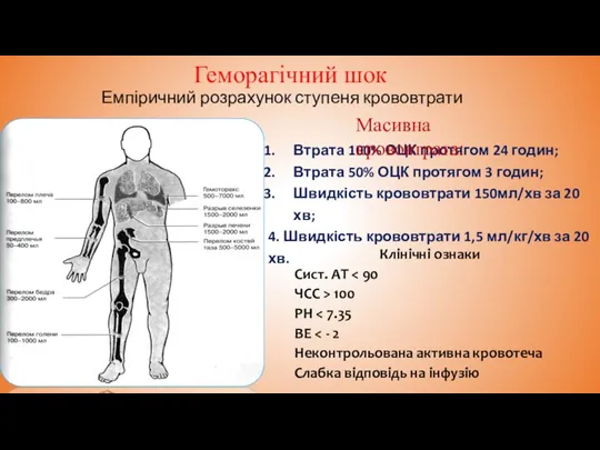 Геморагічний шок Емпіричний розрахунок ступеня крововтрати Втрата 100% ОЦК протягом 24 годин;