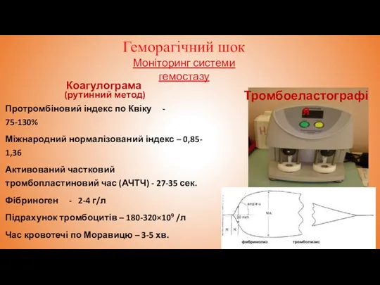 Геморагічний шок Коагулограма (рутинний метод) Протромбіновий індекс по Квіку - 75-130% Міжнародний