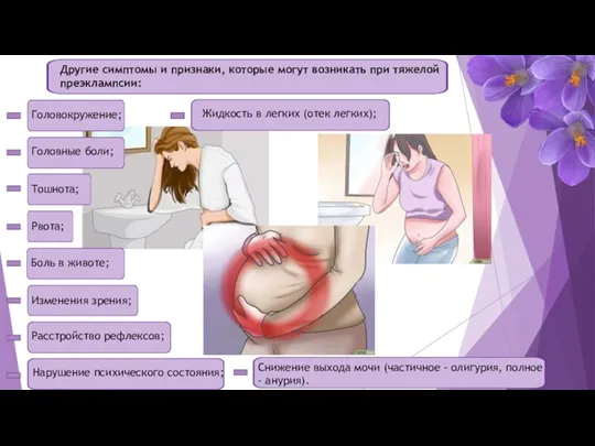 Другие симптомы и признаки, которые могут возникать при тяжелой преэклампсии: Головокружение; Головные