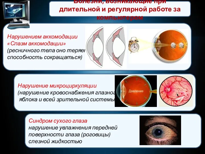 Болезни, возникающие при длительной и регулярной работе за компьютером Нарушением аккомодации «Спазм