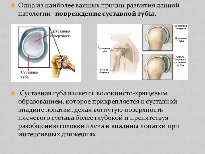 Одна из наиболее важных причин развития данной патологии -повреждение суставной губы. Суставная