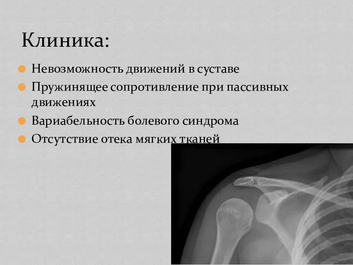 Клиника: Невозможность движений в суставе Пружинящее сопротивление при пассивных движениях Вариабельность болевого