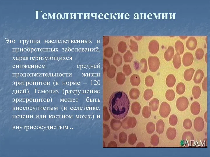Гемолитические анемии Это группа наследственных и приобретенных заболеваний, характеризующихся снижением средней продолжительности