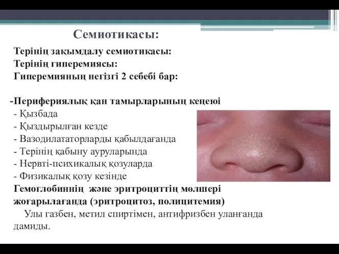 Семиотикасы: Терінің зақымдалу семиотикасы: Терінің гиперемиясы: Гиперемияның негізгі 2 себебі бар: Перифериялық