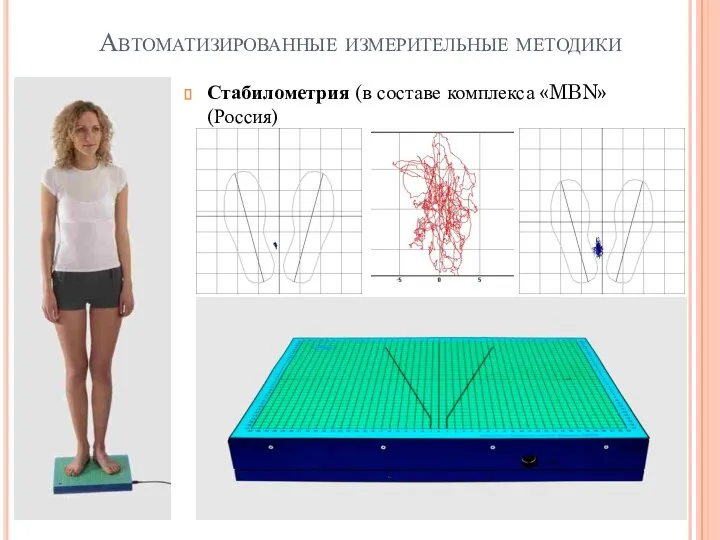 Автоматизированные измерительные методики Стабилометрия (в составе комплекса «MBN» (Россия)