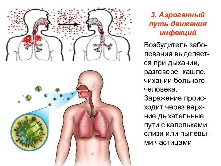 3. Аэрогенный путь движения инфекций Возбудитель забо-левания выделяет-ся при дыхании, разговоре, кашле,