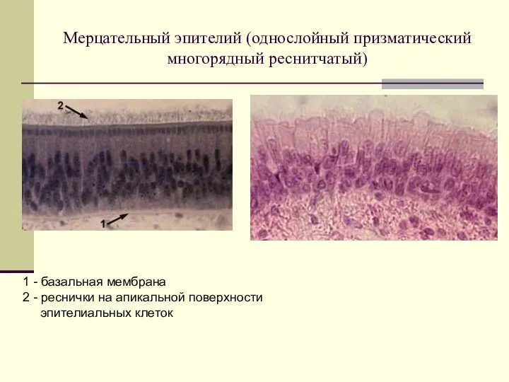 Мерцательный эпителий (однослойный призматический многорядный реснитчатый) 1 - базальная мембрана 2 -