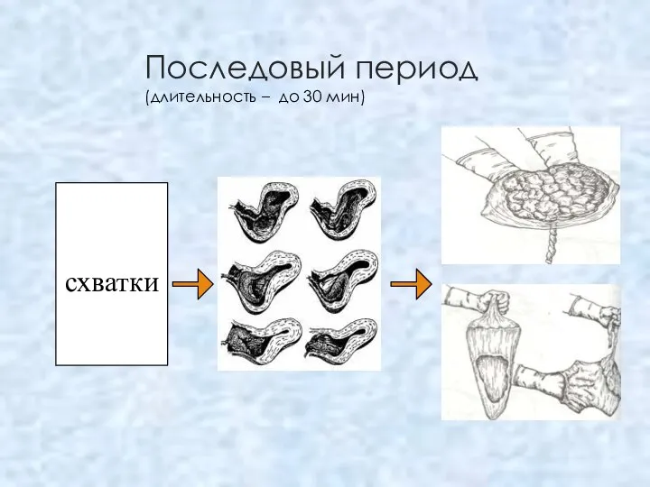 Последовый период (длительность – до 30 мин) схватки